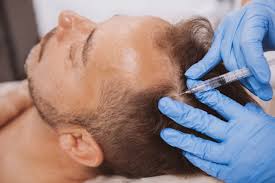 PRP therapy