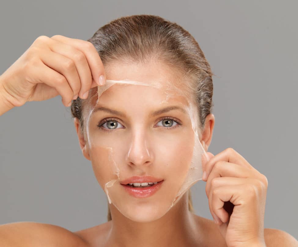 Chemical peeling